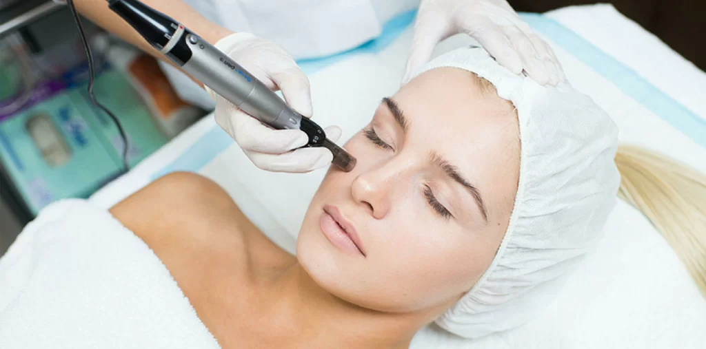 Lady Receiving Microneedling Treatment